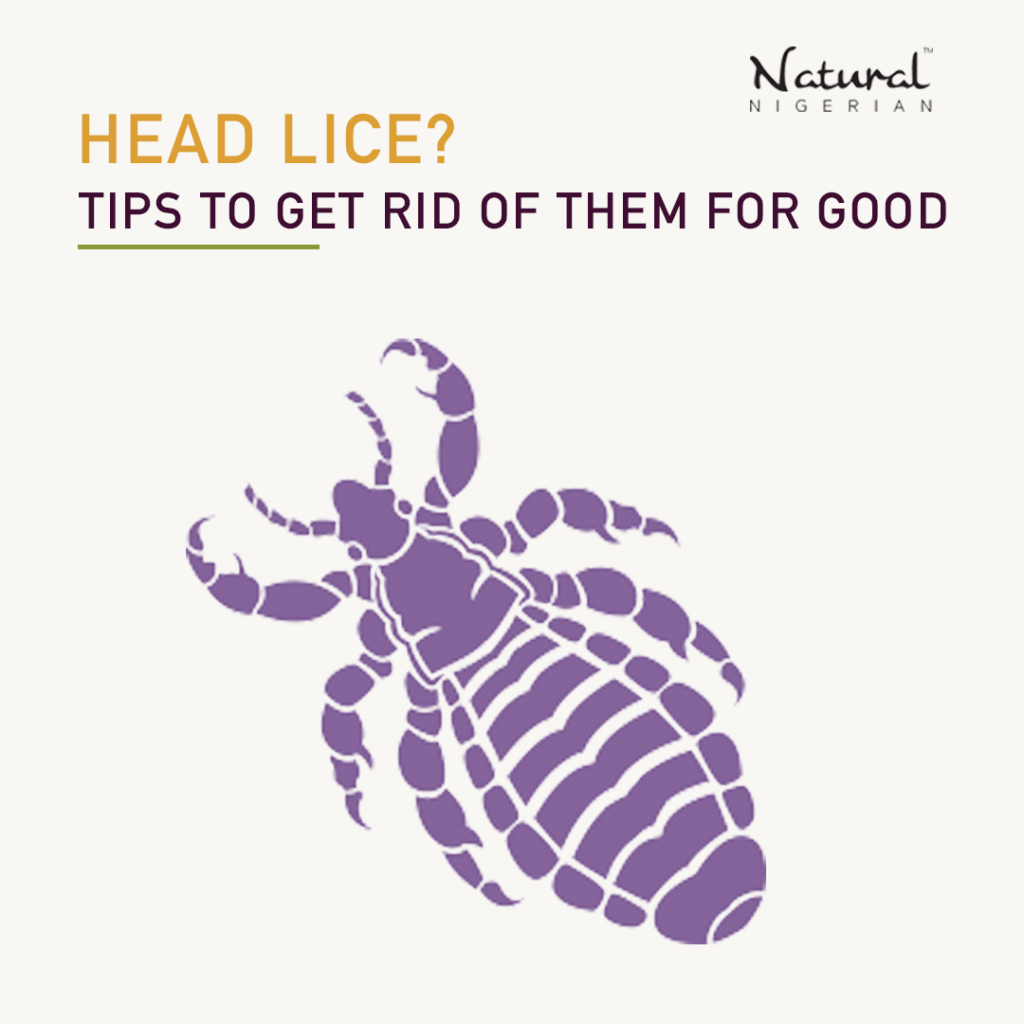 Head Lice? Tips to get rid of them for good. - Natural Nigerian